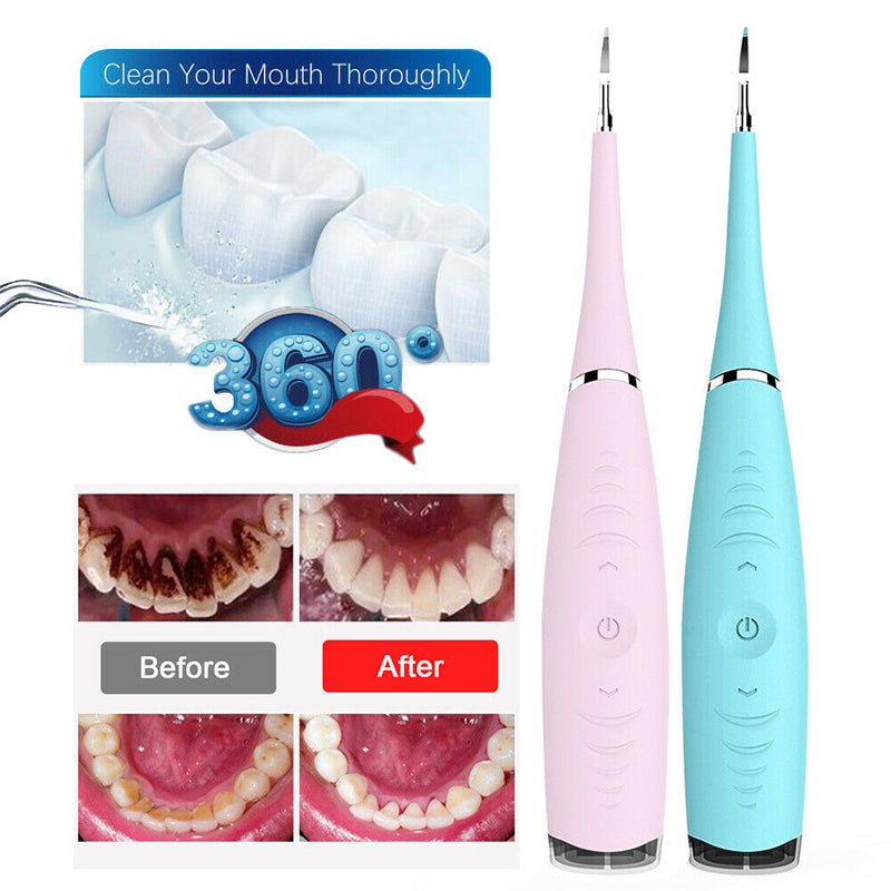 Ultrasonic Tooth Cleaner